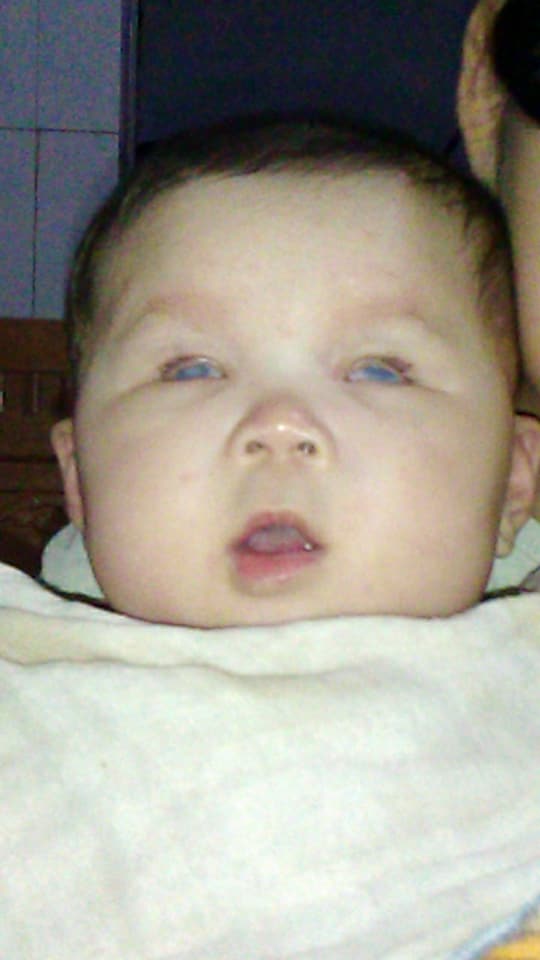 Tâm thư của bà mẹ trẻ mong con gái được thay giác mạc