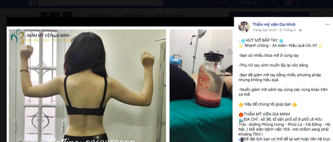 Thẩm mỹ viện Gia Minh: Quảng cáo thực hiện các dịch vụ không phép 
