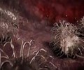 Hiểu đúng và phòng ngừa vi khuẩn ăn thịt người