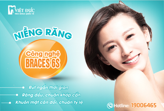 Niềng răng thẩm mỹ công nghệ Braces 6s tại nha khoa quốc tế Việt Đức