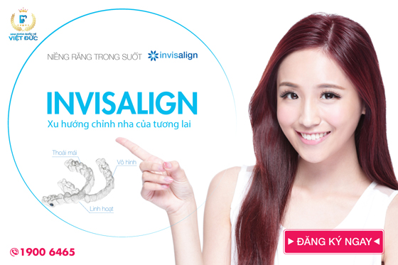 Niềng răng Invisalign tại nha khoa quốc tế Việt Đức