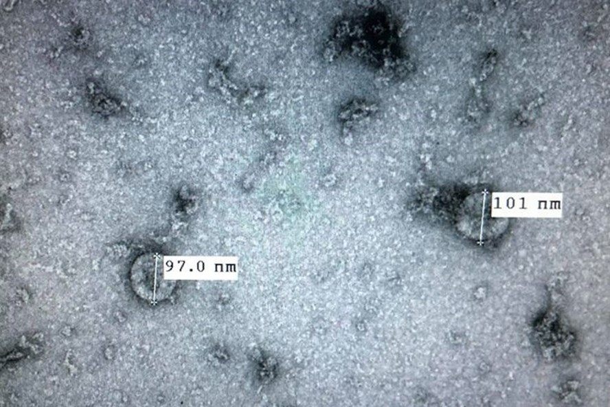 Việt Nam nuôi cấy và phân lập thành công virus Corona mới