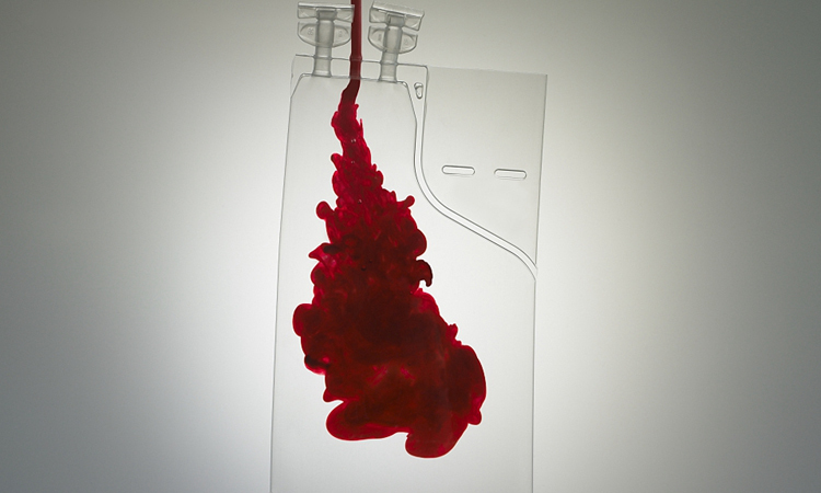 Huyết tương người khỏi bệnh có thể chữa trị COVID-19