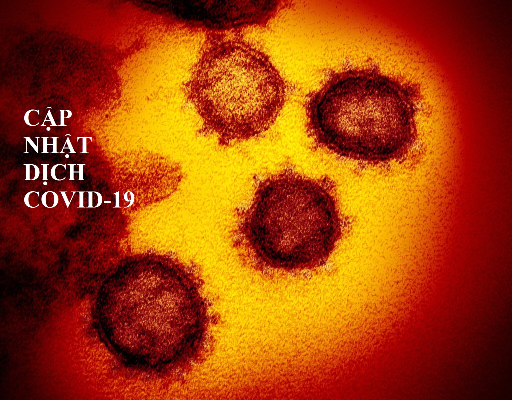 Cập nhật dịch COVID-19 tối ngày 283 Hơn 602.000 người trên thế giới nhiễm SARS-Cov-2