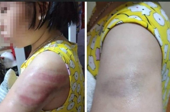 Đình chỉ giáo viên dùng thước đánh học sinh ở Nam Định