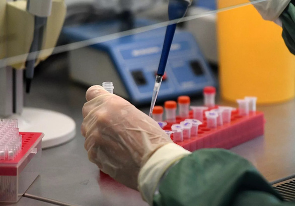 Bảo hiểm chi trả phí xét nghiệm Covid 19 như thế nào