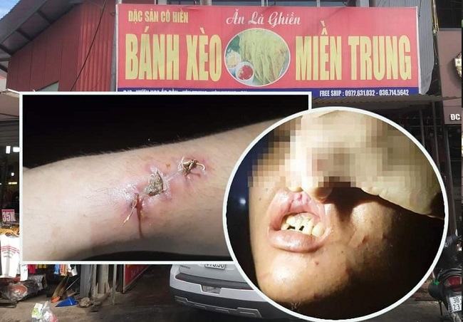 Chủ quán bánh xèo tại Bắc Ninh dùng dao, chày, xẻng đánh đập nhân viên