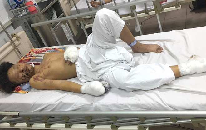 Đua nhau tự chế pháo nổ, hiểm họa khôn lường