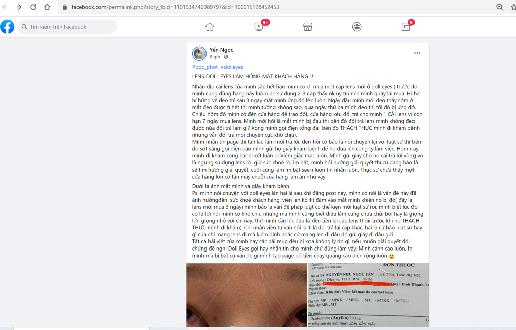 Doll Eyes – Thương hiệu kính áp tròng nổi tiếng tại Việt Nam bị khách hàng tố “làm hỏng mắt”