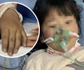 Bé gái 5 tuổi bị ngộ độc do ăn kim chi tự làm 