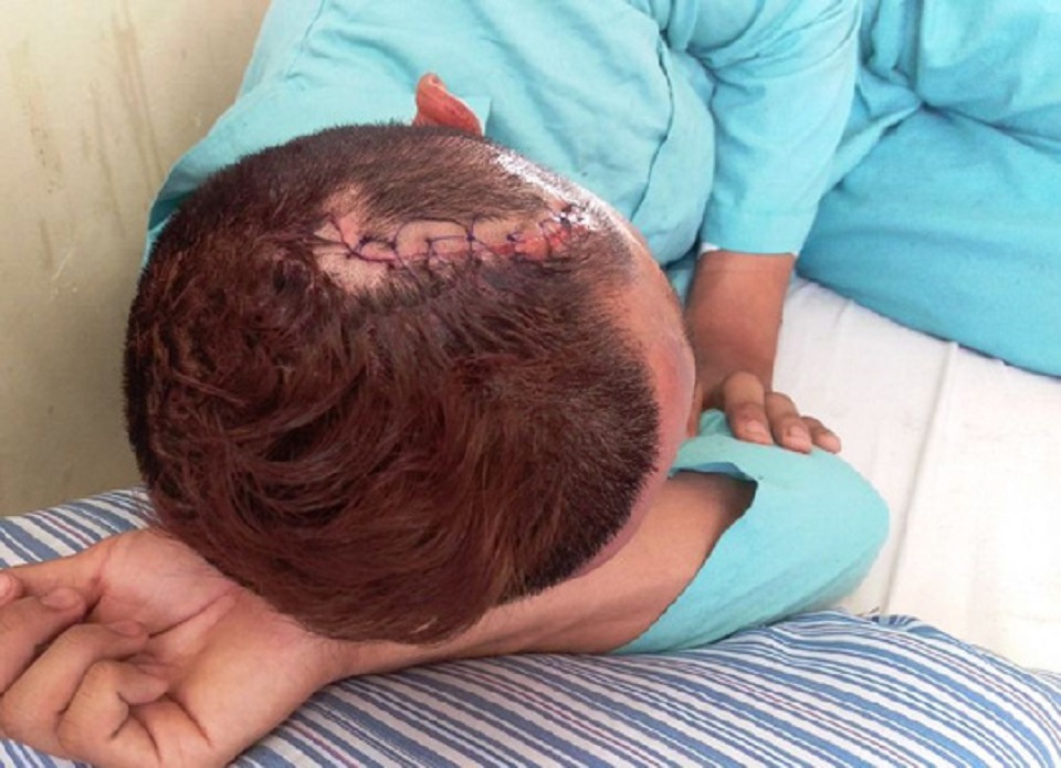 Bị điểm thấp, cha đánh con tét đầu còn ngăn không cho đưa đi viện 