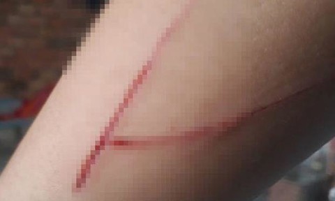 Người phụ nữ tự gây thương tích rồi báo bị cướp sau khi tiêu hết tiền