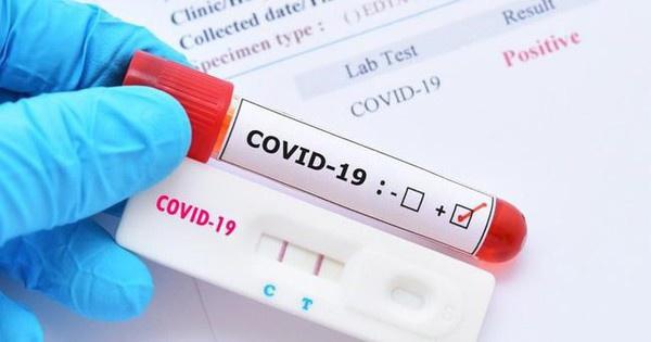 Bộ Tài chính phản hồi việc đưa sản phẩm test nhanh Covid-19 vào bình ổn giá
