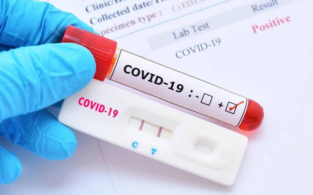 Bộ Y tế yêu cầu doanh nghiệp báo cáo giá bán test xét nghiệm Covid-19