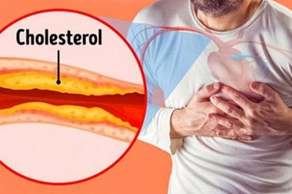 Kiểm soát biến chứng của rối loạn lipid máu nhờ dùng thảo dược