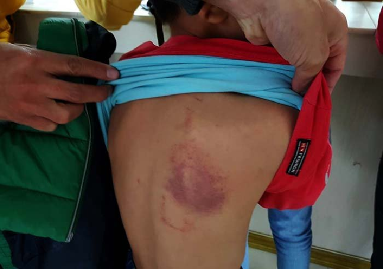 Tạm dừng công tác giáo viên đánh học sinh tím người tại Hải Phòng