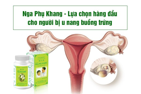 Nga Phụ Khang - Lựa chọn hàng đầu cho người bị u nang buồng trứng