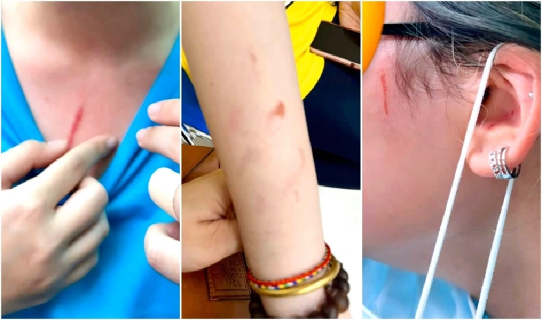 Bộ GDĐT đề nghị TP.HCM xử lý vụ phụ huynh tố con bị đánh ở trường quốc tế