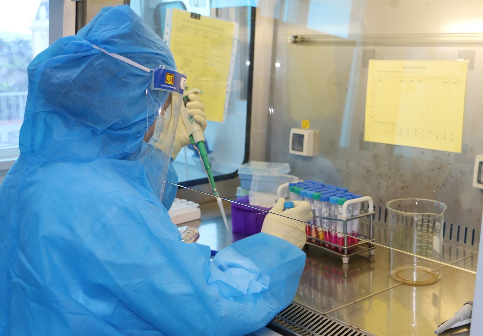 Hà Nội Bệnh viện Bạch Mai ghi nhận ca biến chủng BA.5 đầu tiên tại cộng đồng