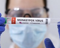 Hai quốc gia có ca tử vong vì đậu mùa khỉ đầu tiên bên ngoài châu Phi