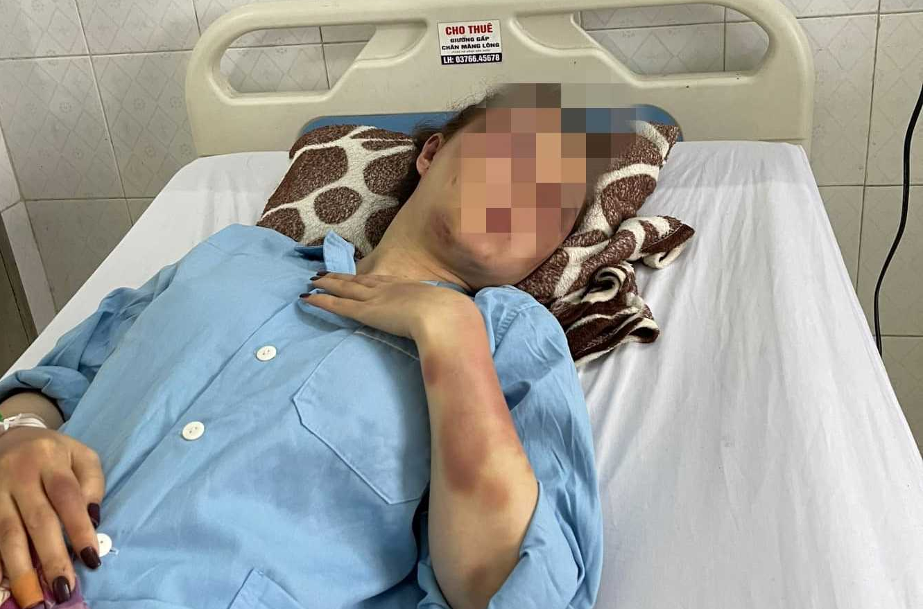 Công an vào cuộc vụ cán bộ Quản lý thị trường ở Thanh Hóa đánh bạn gái dã man