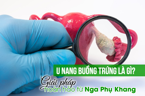U nang buồng trứng là gì Giải pháp hoàn hảo từ Nga Phụ Khang