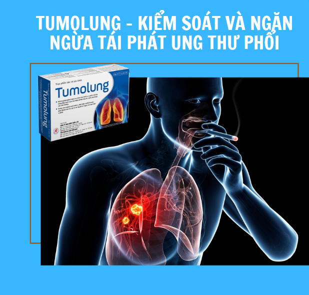 Tumolung - Kiểm soát hiệu quả và ngăn ngừa tái phát ung thư phổi