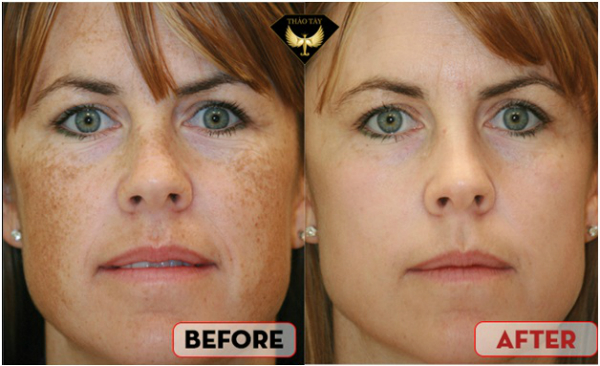 baby-face-cong-nghe-cang-bong-da-chun-han-1