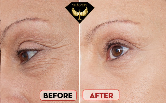 baby-face-cong-nghe-cang-bong-da-chun-han-2