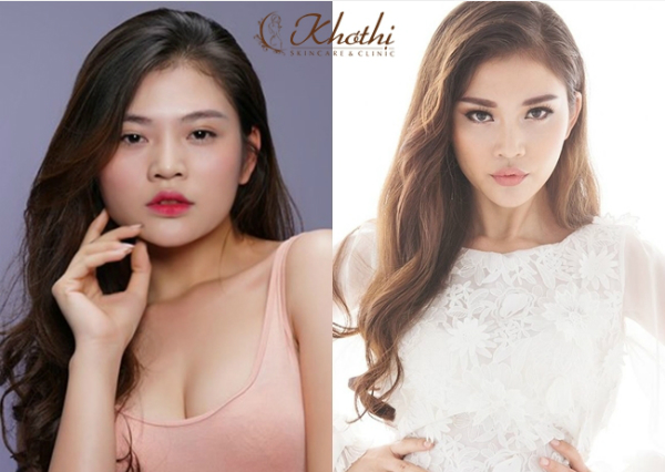 chieu-thuc-tao-cam-v-line-cua-chung-huyen-thanh-xin-edit--2