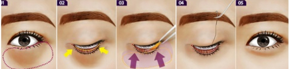 tra-lai-tuoi-xuan-cho-doi-mat-bang-cong-nghe-cat-mi-han-quoc-3-trong-mot-1