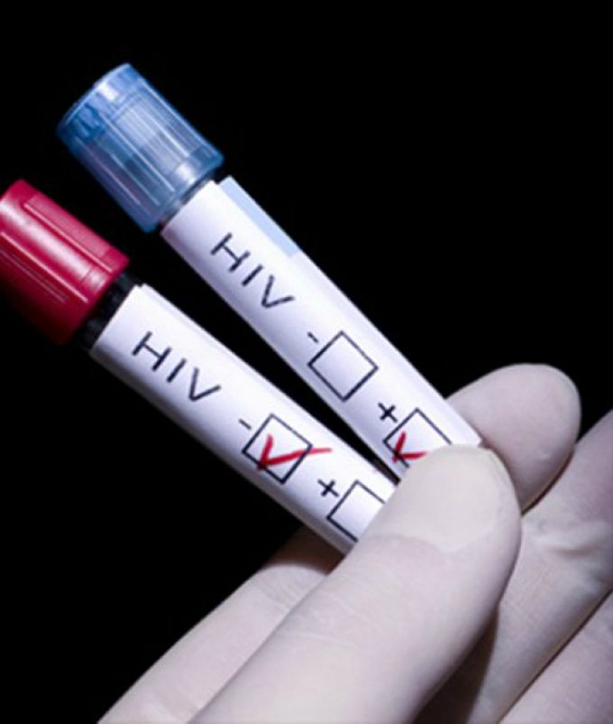 HIV căn bệnh thế kỷ giết chết bao nhiêu người