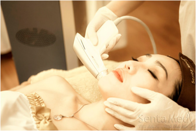 TOP 5 công nghệ xóa sẹo lõm do trứng cá dẫn đầu thị trường