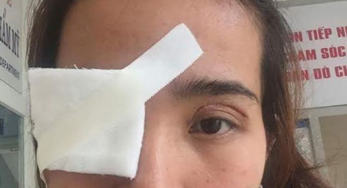 Chủ spa biến mất sau khi làm biến chứng mắt của một khách hàng xinh đẹp
