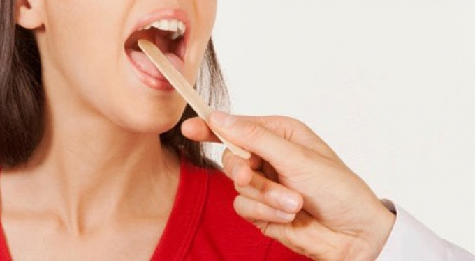 6 triệu chứng ung thư vòm họng cần phát hiện sớm để chữa trị kịp thời