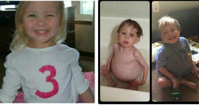 Lá gan của Olivia (trái) đã cứu sống cậu bé Lucas. Trong hình là ảnh cậu bé Lucas trước và sau khi thực hiện ca phẫu thuật ghép gan.